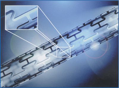 Detailed view of a medical stent, highlighting its design and structure, illustrating its purpose in vascular procedures.